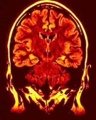 Diagnose und Therapie neurologischer Erkrankungen