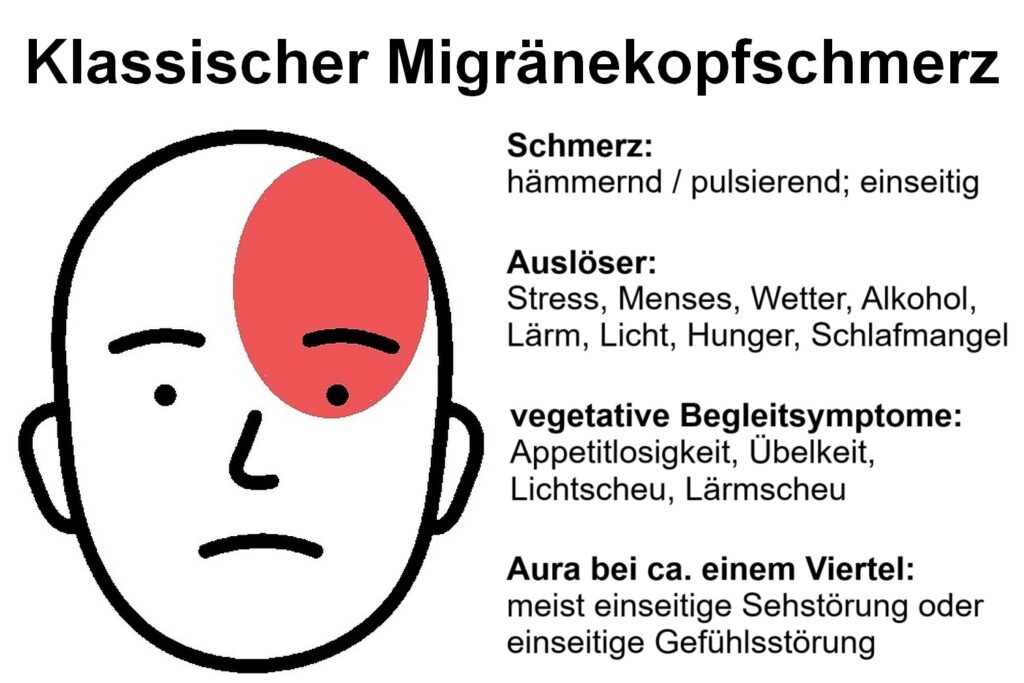 migraene schmerz lokalisation